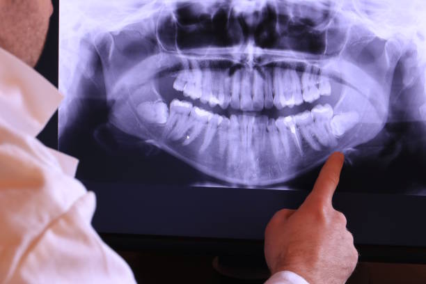Best Teeth Whitening  in Hansville, WA